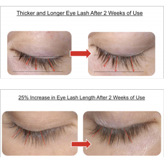 Lash Growth Treatment - Eyeliner - LAshX® PRO/Line - Prolongs Lash Extension Wear - LAshX - Healthier Lash Extensions Better Lash Retention